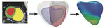Using deep learning to predict clinical outcomes in heart failure