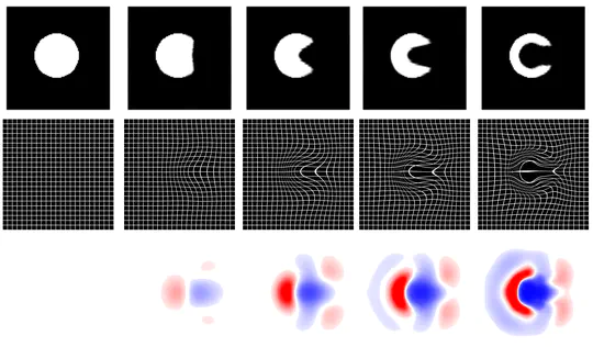 Nesterov accelerated ADMM for diffeomorphic image registration