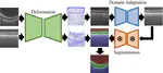 Structure and intensity unbiased translation for image segmentation