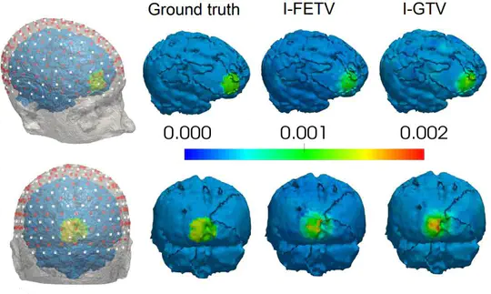 Graph- and finite element-based total variation models for the inverse problem in diffuse optical tomography