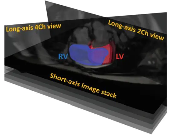Self-supervised learning for cardiac MR segmentation by anatomical position prediction
