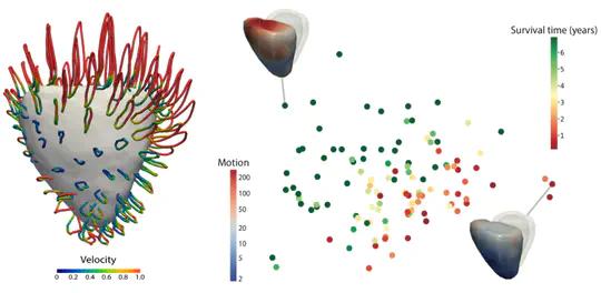 Deep learning cardiac motion analysis for human survival prediction
