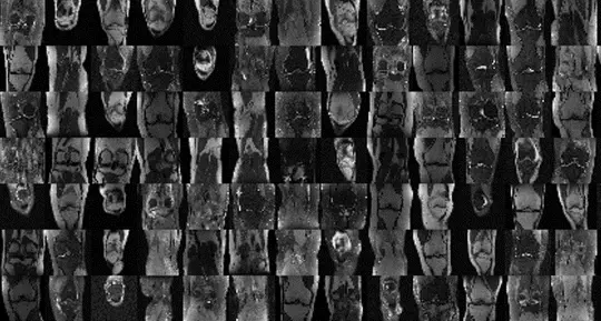 VS-Net: Variable splitting network for accelerated parallel MRI reconstruction